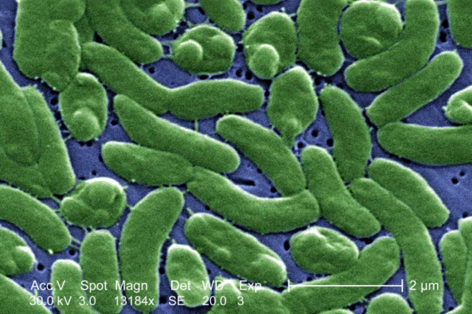 Avec la mer de plus en plus chaude, la redoutée bactérie « mangeuse de chair » prolifère : la crise climatique s'expose à de nouvelles infections