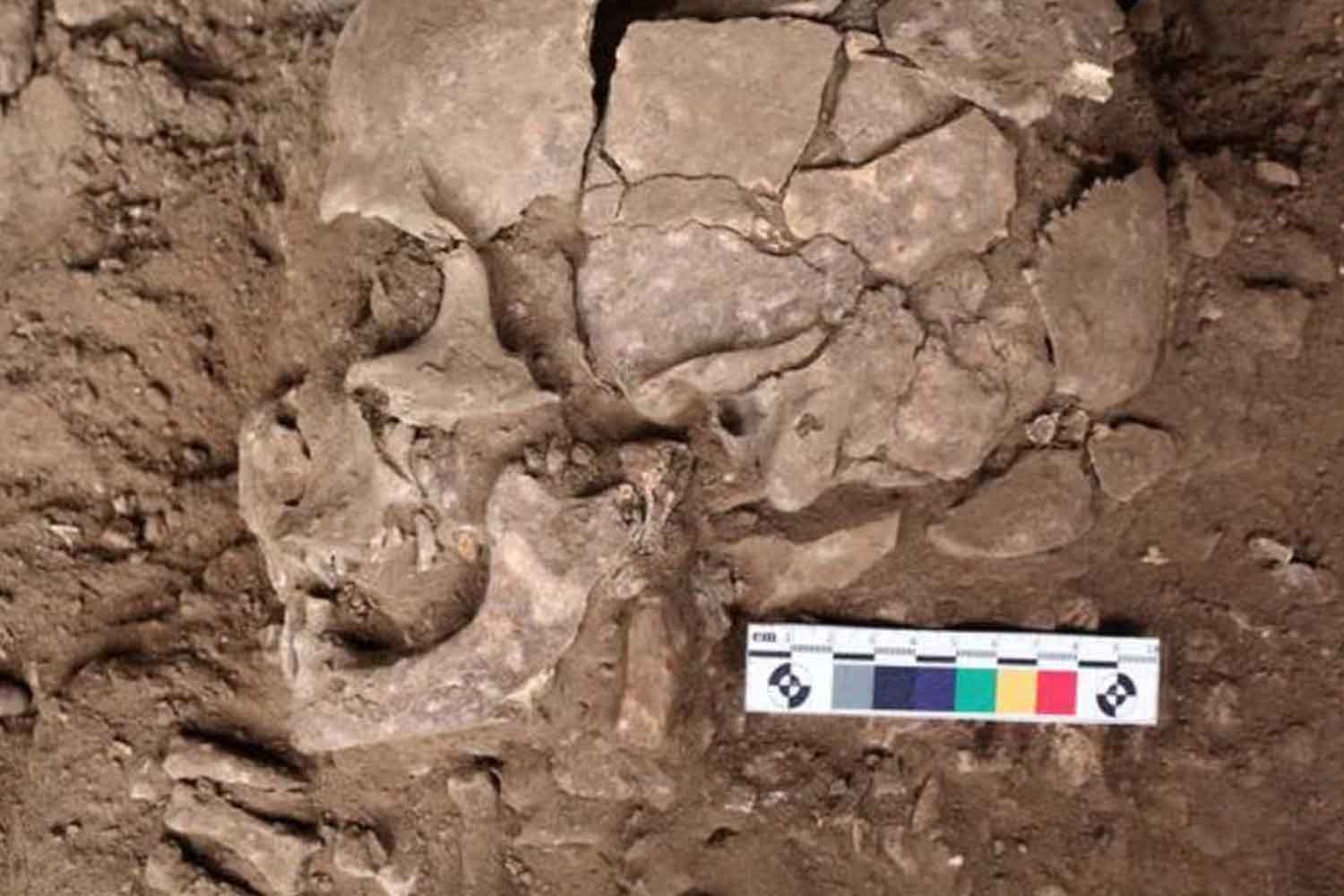 sostanza psicoattiva nei denti di 25.000 anni